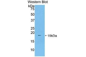 Western blot analysis of the recombinant protein. (Prothrombin Antikörper  (AA 44-200))