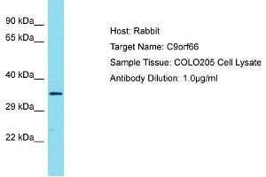 Host: Rabbit Target Name: C9ORF66 Sample Tissue: Human COLO205 Whole Cell Antibody Dilution: 1ug/ml (C9ORF66 Antikörper  (C-Term))