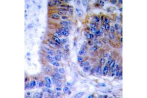Immunohistochemistry (IHC) image for anti-Tumor Necrosis Factor, alpha-Induced Protein 1 (Endothelial) (TNFAIP1) (Center) antibody (ABIN7299500)