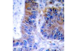 Immunohistochemical analysis of TNFAIP1 staining in human colon formalin fixed paraffin embedded tissue section. (TNFAIP1 Antikörper  (Center))