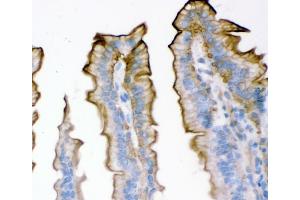 IHC analysis of Plectin using anti-Plectin antibody (ABIN3043900). (PLEC Antikörper  (Middle Region))