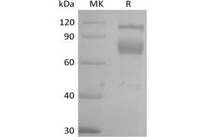 Western Blotting (WB) image for Interleukin 2 Receptor, beta (IL2RB) protein (Fc Tag) (ABIN7320916) (IL2 Receptor beta Protein (Fc Tag))