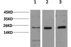Western Blotting (WB) image for anti-Chromobox Homolog 5 (CBX5) antibody (ABIN5957538) (CBX5 Antikörper)