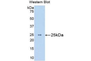 Western Blotting (WB) image for anti-Mannan-Binding Lectin serine Peptidase 2 (MASP2) (AA 22-142) antibody (ABIN1859765) (MASP2 Antikörper  (AA 22-142))