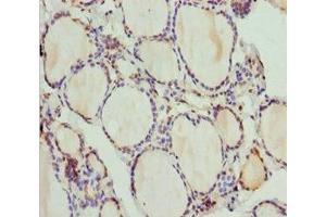 Immunohistochemistry of paraffin-embedded human thyroid tissue using ABIN7163635 at dilution of 1:100 (PLEKHA1 Antikörper  (AA 285-404))