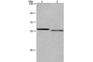 Western Blot analysis of K562 and A431 cell using FRK Polyclonal Antibody at dilution of 1:1200 (FRK Antikörper)