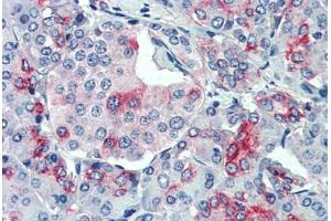 Anti-SLC11A2 antibody  ABIN1049329 IHC staining of human, pancreas. (SLC11A2 Antikörper  (Internal Region))