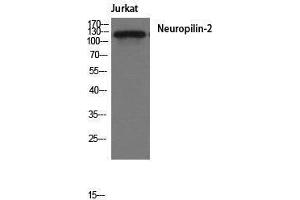 Western Blotting (WB) image for anti-Neuropilin 2 (NRP2) (Internal Region) antibody (ABIN3185856)