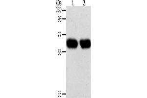 Gel: 10 % SDS-PAGE, Lysate: 40 μg, Lane 1-2: Lncap cells, SKOV3 cells, Primary antibody: ABIN7131276(SYT7 Antibody) at dilution 1/200, Secondary antibody: Goat anti rabbit IgG at 1/8000 dilution, Exposure time: 1 minute