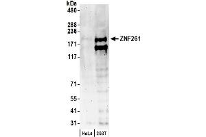Western Blotting (WB) image for anti-Zinc Finger Protein 261 (ZMYM3) (AA 250-300) antibody (ABIN7449408)