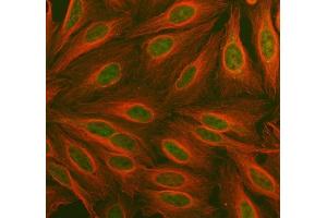 IF analysis of PDK2 using anti-PDK2 antibody (ABIN5693279) and anti-Tubulin Alpha antibody (ABIN7600339). (PDK2 Antikörper  (AA 81-177))