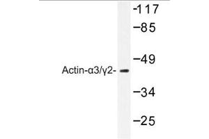 Image no. 1 for anti-Actin, gamma 2, Smooth Muscle, Enteric (ACTG2) antibody (ABIN265300)