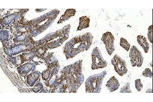IHC analysis of YTHDF2 using anti-YTHDF2 antibody (ABIN7603191). (YTHDF2 Antikörper  (N-Term))