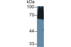 Detection of C8a in Mouse Serum using Polyclonal Antibody to Complement Component 8a (C8a) (C8A Antikörper  (AA 21-300))