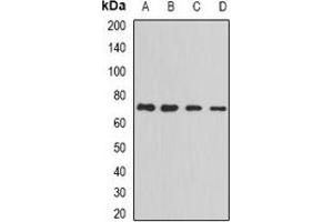 Western blot analysis of PRC1 expression in MCF7 (A), Jurkat (B), Hela (C), HepG2 (D) whole cell lysates. (PRC1 Antikörper)