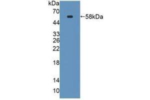 Western blot analysis of recombinant Mouse SPTLC3. (SPTLC3 Antikörper  (AA 80-563))