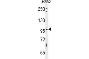 Western Blotting (WB) image for anti-Taste Receptor, Type 1, Member 2 (TAS1R2) antibody (ABIN2996356) (TAS1R2 Antikörper)