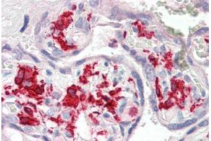 Human Placenta (formalin-fixed, paraffin-embedded) stained with AIF1 antibody ABIN337129 at 2. (Iba1 Antikörper  (AA 42-56))
