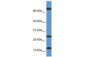 WB Suggested Anti-TARP Antibody Titration: 1. (TARP Antikörper  (N-Term))