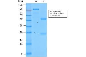 SDS-PAGE Analysis of Purified Involucrin Rabbit Recombinant Monoclonal Antibody (IVRN/2113R).