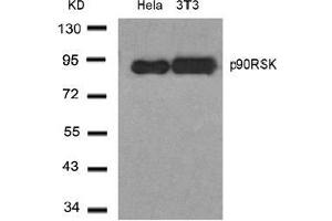 Image no. 1 for anti-Ribosomal Protein S6 Kinase, 90kDa, Polypeptide 1 (RPS6KA1) (Thr348) antibody (ABIN197328) (RPS6KA1 Antikörper  (Thr348))