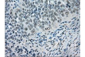 Image no. 6 for anti-Crystallin, alpha B (CRYAB) antibody (ABIN1497645) (CRYAB Antikörper)