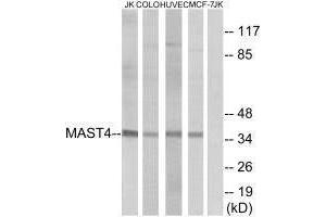 Western blot analysis of extracts from Jurkat cells, COLO cells, HUVEC cells and MCF-7 cells, using MAST4 antibody. (MAST4 Antikörper)