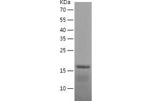 Western Blotting (WB) image for BTG Family, Member 2 (BTG2) (AA 1-158) protein (His tag) (ABIN7122055)