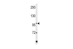 Western blot analysis of COL6A1 antibody in Y79 cell line lysates (35ug/lane) (COL6A1 Antikörper  (C-Term))