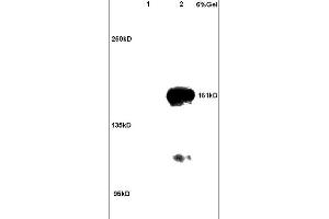 Lane 1: rat brain lysates Lane 2: human colon carcinoma lysates probed with Anti ROCK2 Polyclonal Antibody, Unconjugated (ABIN673359) at 1:200 in 4C. (ROCK2 Antikörper  (AA 1001-1300))