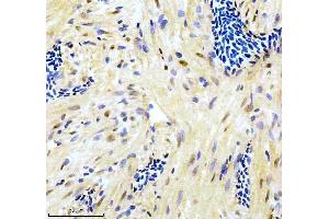 IHC analysis of GATA6 using anti-GATA6 antibody (AZQ6NW63).