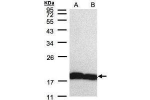 WB Image Sample(30 μg of whole cell lysate) A:H1299 B:HeLa S3, 12% SDS PAGE antibody diluted at 1:5000