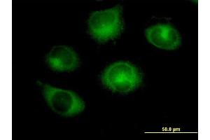 Immunofluorescence of purified MaxPab antibody to RABGAP1 on HeLa cell. (RABGAP1 Antikörper  (AA 1-997))