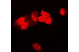 Immunofluorescent analysis of Focal Adhesion Kinase staining in HeLa cells. (FAK Antikörper  (Center))