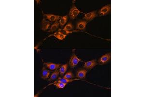 Immunofluorescence (IF) image for anti-Serpin Peptidase Inhibitor, Clade G (C1 Inhibitor), Member 1 (SERPING1) (AA 201-500) antibody (ABIN3022430)