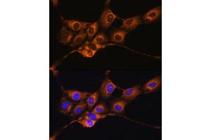 Immunofluorescence analysis of NIH/3T3 cells using SERPING1 antibody ( ABIN3022429, ABIN3022430, ABIN3022431 and ABIN6218816) at dilution of 1:100. (SERPING1 Antikörper  (AA 201-500))