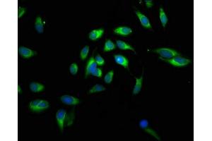 Immunofluorescent analysis of Hela cells using ABIN7146564 at dilution of 1:100 and Alexa Fluor 488-congugated AffiniPure Goat Anti-Rabbit IgG(H+L) (Calreticulin Antikörper  (AA 18-415))