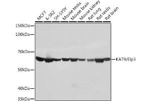 Western blot analysis of extracts of various cell lines, using K/Elp3 Rabbit mAb (ABIN1680361, ABIN3015008, ABIN3015009 and ABIN7101302) at 1:1000 dilution. (ELP3/KAT9 Antikörper)