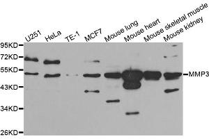 Western blot analysis of extracts of various cell lines, using MMP3 antibody (ABIN5970544) at 1/1000 dilution. (MMP3 Antikörper)