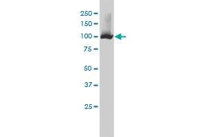 NNT monoclonal antibody (M01), clone 1D6 Western Blot analysis of NNT expression in HepG2 . (NNT Antikörper  (AA 1-207))