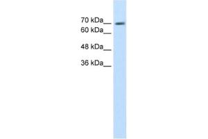Western Blotting (WB) image for anti-EPS8-Like 1 (EPS8L1) antibody (ABIN2462593) (EPS8-Like 1 Antikörper)