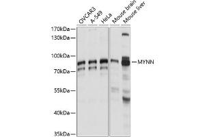 Western blot analysis of extracts of various cell lines, using MYNN antibody (ABIN7268741) at 1:1000 dilution. (Myoneurin Antikörper  (AA 1-300))