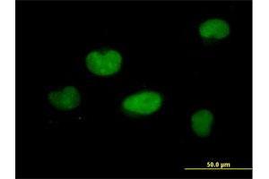 Immunofluorescence of purified MaxPab antibody to ZNF449 on HeLa cell. (ZNF449 Antikörper  (AA 1-518))