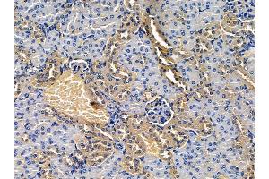 ABIN7094522 and ABIN7098571 at 1/100 staining mouse kidney tissue by IHC-P. (Tyrosinase-Related Protein 1 Antikörper  (Internal Region))