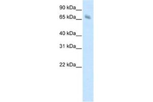 Western Blotting (WB) image for anti-Kelch-like protein 41 (KLHL41) antibody (ABIN2461775)