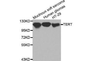 Western blot analysis of extracts of various cell lines, using TERT antibody. (TERT Antikörper  (C-Term))