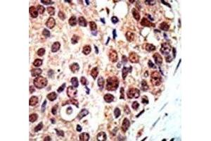 Immunohistochemistry (IHC) image for anti-Protein Arginine Methyltransferase 3 (PRMT3) (AA 460-491) antibody (ABIN3032359)