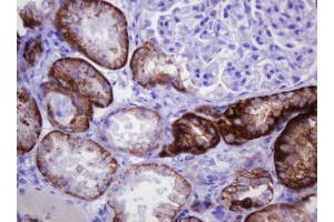 Image no. 5 for anti-Carbonic Anhydrase 12 (CA12) antibody (ABIN1497067)