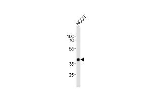 Anti-DA4 Antibody (Center) at 1:1000 dilution + NCCIT whole cell lysates Lysates/proteins at 20 μg per lane. (DPPA4 Antikörper  (AA 107-142))