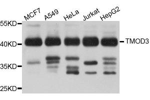 Western Blotting (WB) image for anti-Tropomodulin 3 (TMOD3) (AA 1-352) antibody (ABIN1683055) (TMOD3 Antikörper  (AA 1-352))
